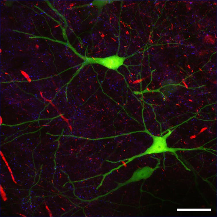 Beeld van verschillende soorten synapsen in een muizenhersenschijfje.