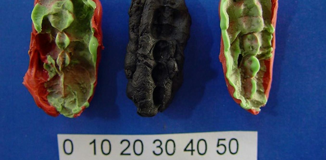 DNA van kauwgom uit het stenen tijdperk werpt licht op