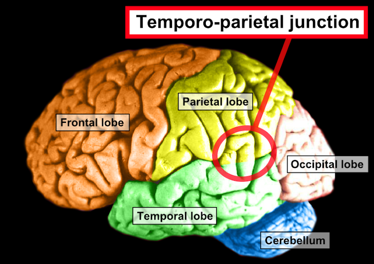 Afbeelding van de temporoparietale junctie.