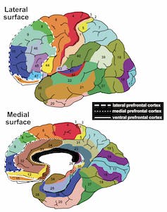 Een kaart van verschillende hersengebieden